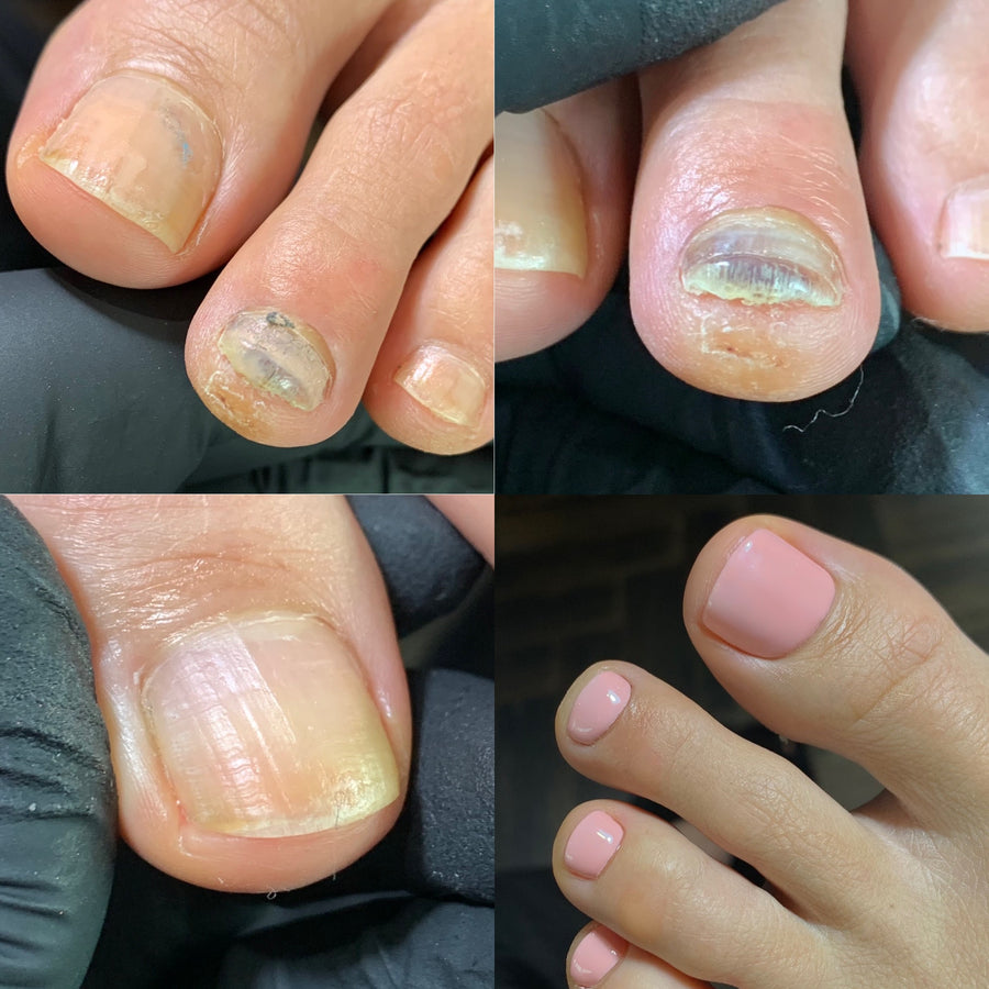 DRY* Toe Overhaul (Gel/Shellac) Initial Service