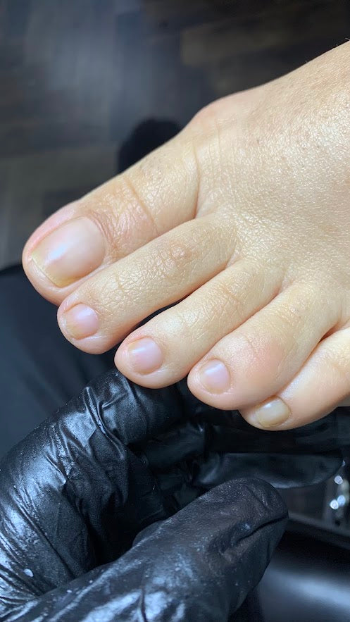 DRY* Toe Maintenance (Naked/No Colour) Follow-Up