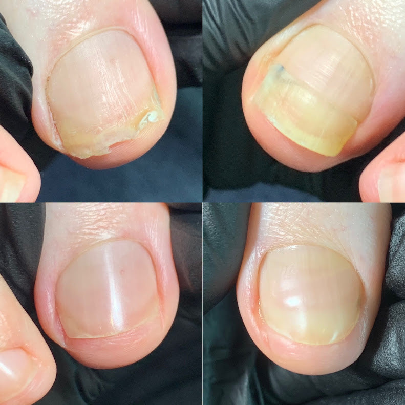 DRY* Toe Overhaul (Naked/No Colour) Initial Service